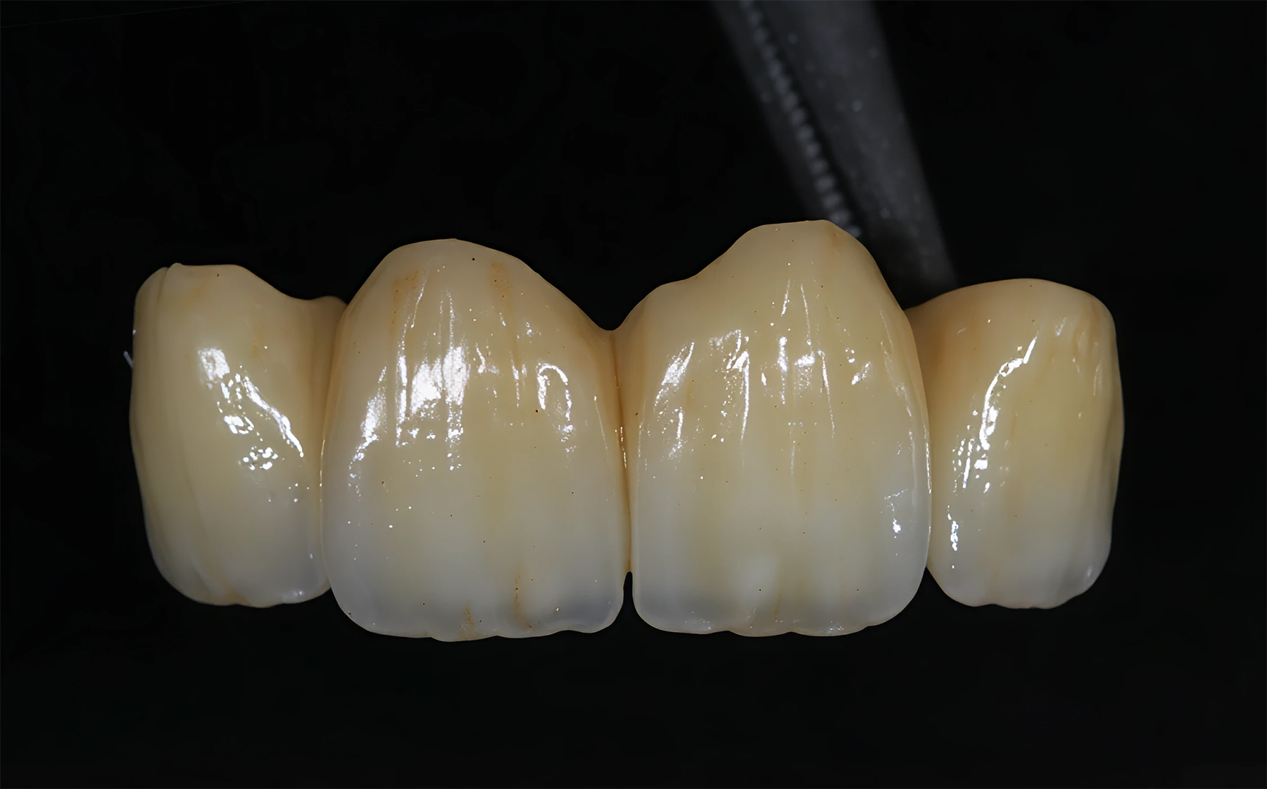 Zirconia Stratificata lavorazione